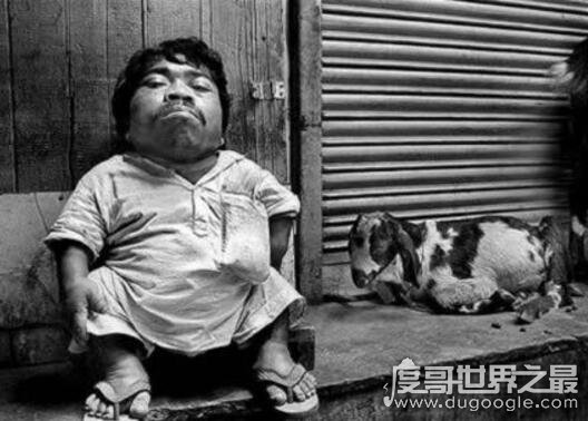 世界最矮的人排名,十大世界最矮袖珍人(最矮一位54.6cm)