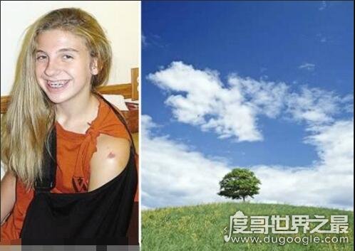 世界十大最离奇的雷击事件,卫生间上厕所下体被雷劈