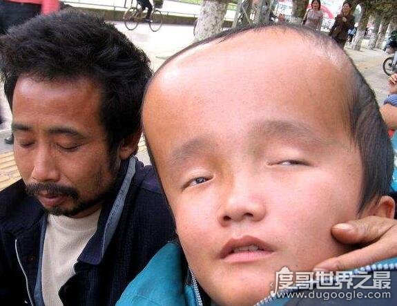 十大最坑爹的养生常识,流鼻血的时候千万不要抬下巴