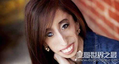 骷髅女孩丽兹·维拉斯奎兹,上学第一天就被所以人排斥