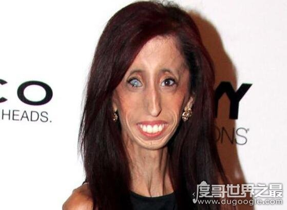 骷髅女孩丽兹·维拉斯奎兹,上学第一天就被所以人排斥